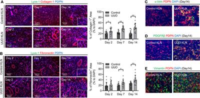 Kidney-Draining Lymph Node Fibrosis Following Unilateral Ureteral Obstruction